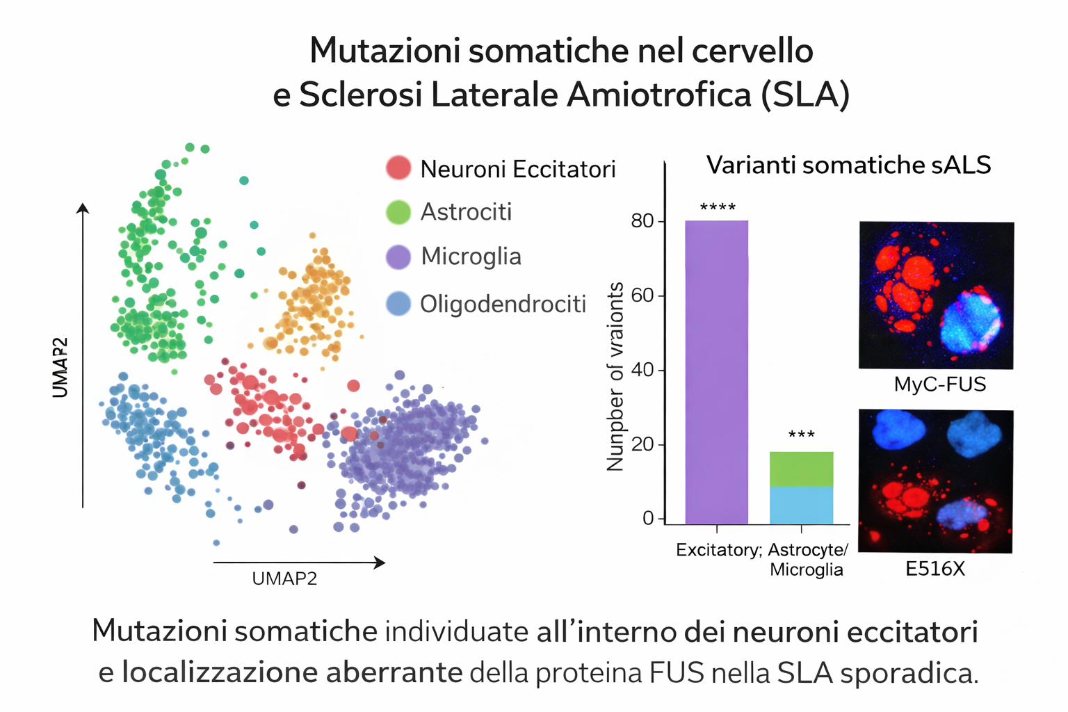 Mutazioni somatiche nel cervello: una nuova chiave per comprendere la SLA